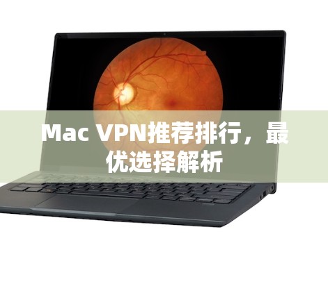 Mac VPN推荐排行,最优选择解析 Mac VPN推荐排行,最优选择解析